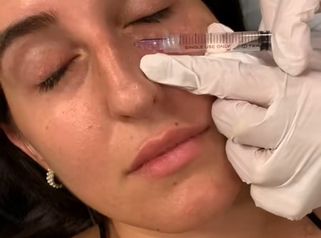 PPM Medical Biorivitalizzazione