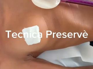 Dottori Paolo & Nicola Pittoni Tecnica Preservè per aumento non invasivo del seno