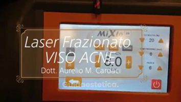 Trattamento Laser Acne - Dott. Aurelio M. Cardaci