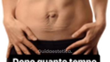 Diastasi parto - Dr Antonio Tambuscio