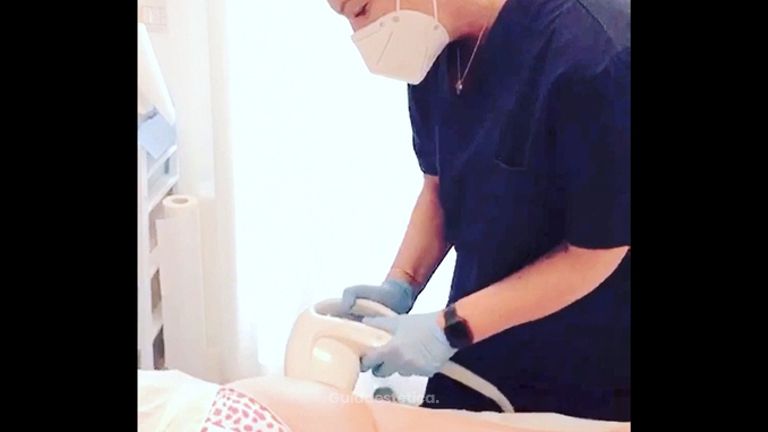 Radiofrequenza - Dott. Virgilio Medical Laser