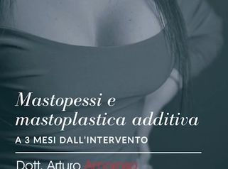 Mastoplastica additiva - Dott. Arturo Amoroso