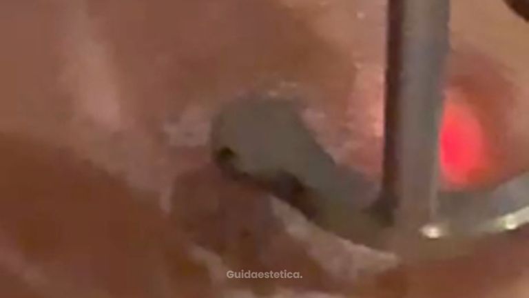 Dott.ssa Cornelia Florea Rimozione tatuaggio con laser: trattamento rapido e non invasivo