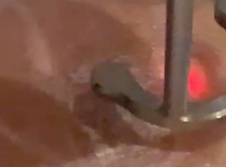 Dott.ssa Cornelia Florea Rimozione tatuaggio con laser: trattamento rapido e non invasivo