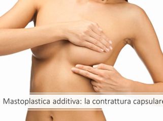 Contrattura capsulare