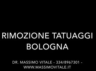 Dott. Vitale: Rimozione tatuaggio