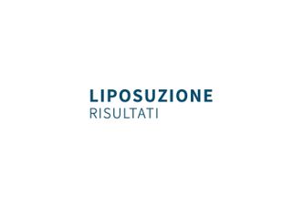 Liposuzione, risultati - Dottor Gianluca Campiglio