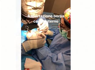 Asportazione borsa