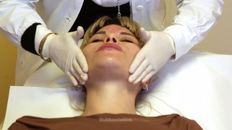 Il filler all'acido ialuronico