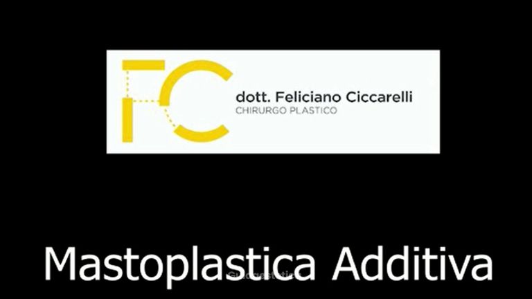 Mastoplastica additiva - Dott. Feliciano Ciccarelli