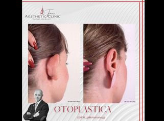 Otoplastica - Aesthetic Clinic del Dott. Giulio Maria Maggi
