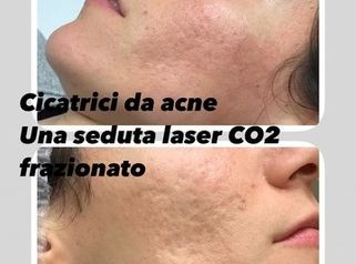 Cicatrici - Studio medico Monica De Stefani