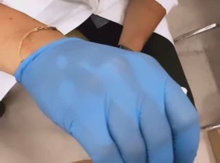 Liposuzione non chirurgica
