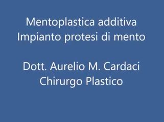 Mentoplastica additiva - Dott. Aurelio M. Cardaci