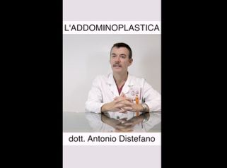 Addominoplastica