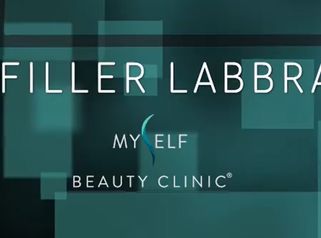 Filler labbra