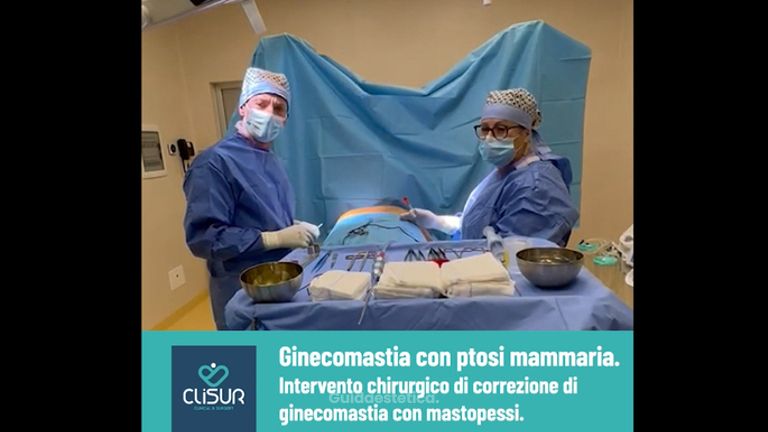 Ginecomastia - Clisur- Clinical & Surgery