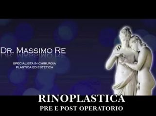 Rinoplastica prima e dopo l'intervento - Dr. Massimo Re