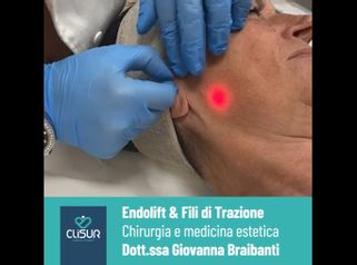 Endolift - Clisur- Clinical & Surgery