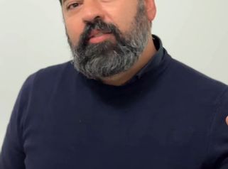 Dott. Antonio Vernillo Visita dopo mastoplastica: Alessia racconta il risultato a un mese