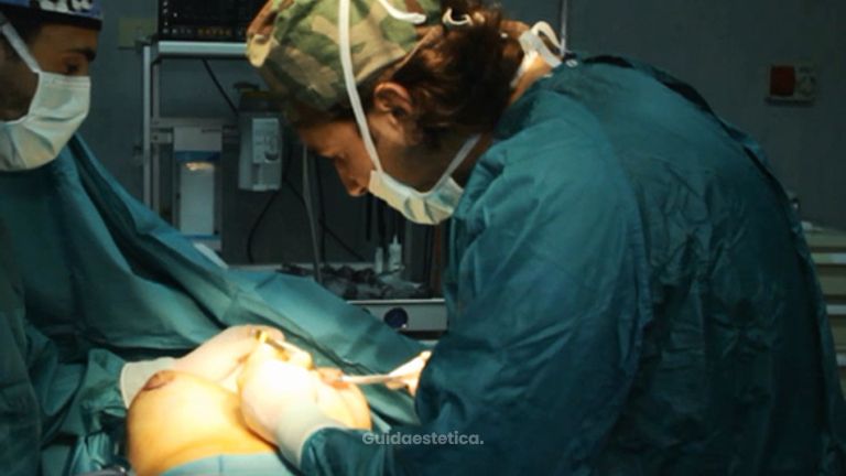 L'intervento di Mastoplastica Additiva, tecnica a confronto