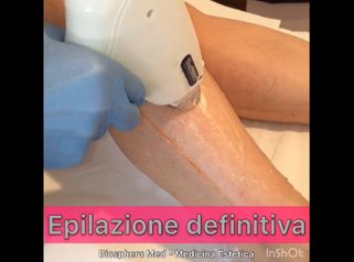 Depilazione laser - Studio medico BiospheraMed