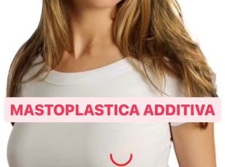 Mastoplastica additiva - Dr Antonio Tambuscio