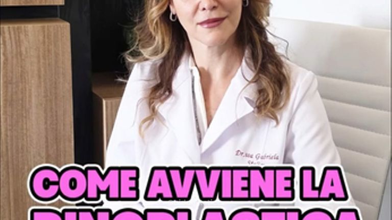 Dott.ssa Gabriela Stelian Rinoplastica moderna precisione, tempi e recupero