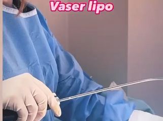 Lipo Vaser - Dott.ssa Federica Giuzio