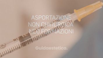 Asportazione