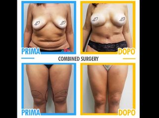 Combined surgery