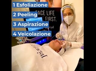 Peeling - Dott.ssa Caminiti Paola Medical SPA