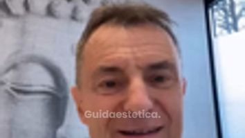 Dott. Stefano Veglio Melasma pigmentazioni del viso associate a gravidanza e pillola