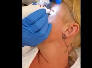 Medestetclinic: Blefaroplastica