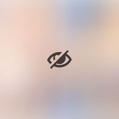 Prof. Dott. Massimiliano Giuliano Prima e dopo mastoplastica additiva: risultato naturale