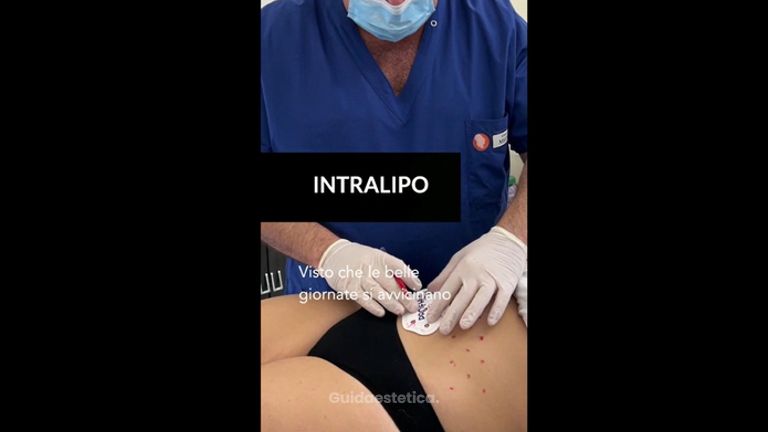 Intralipoterapia - Dott.Maurizio Cursano