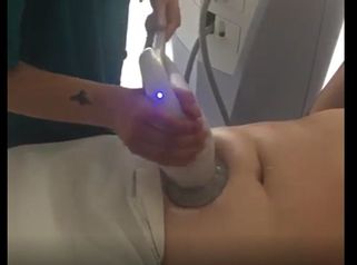 Cavitazion-Ultrasuono per adiposità localizzate Total Body