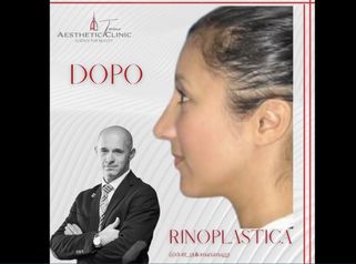 Rinoplastica - Aesthetic Clinic del Dott. Giulio Maria Maggi