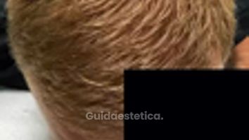 Prof. Dott. Massimiliano Giuliano Prp fattori di crescita