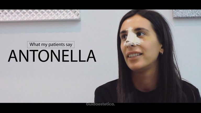 What my patients say: ANTONELLA
