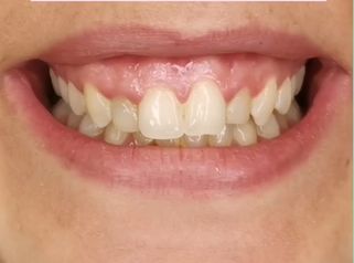 Dott.ssa Irene Pistis Gummy Smile