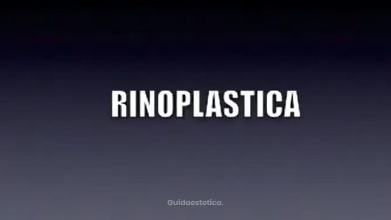 RINOPLASTICA - intervento eseguito dal Dott Massimo Re chirurgo plastico ed estetico.