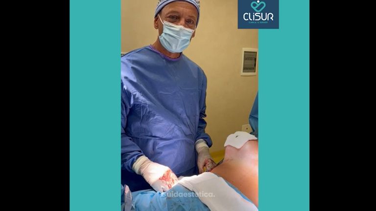 Mastoplastica Additiva - Clisur- Clinical & Surgery