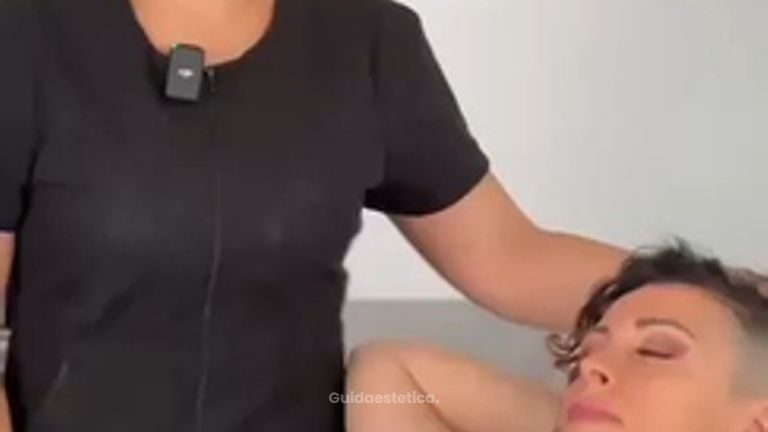 Dott.ssa Irene Pistis Cicatrici post chirurgiche