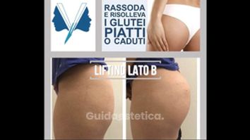 Lifting