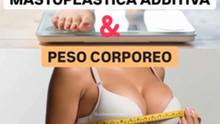 Mastoplastica additiva - Dr Antonio Tambuscio