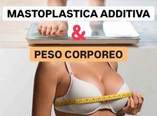 Mastoplastica additiva - Dr Antonio Tambuscio