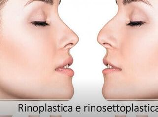 Rinoplastica e rinosettoplastica || Dr Montemurro - Chirurgo Plastico