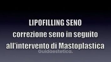 CORREZIONE SENO CON LIPOFILLING. DR. MASSIMO RE