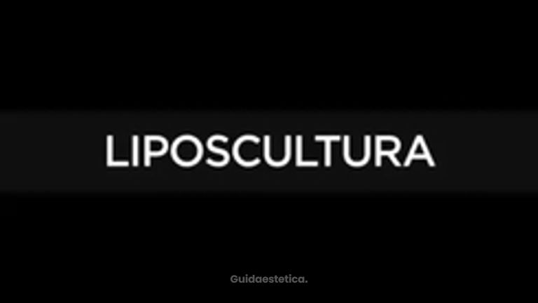 Prof. Giuseppe A. Ferraro Risultati reali di una liposcultura maschile con corpo più definito